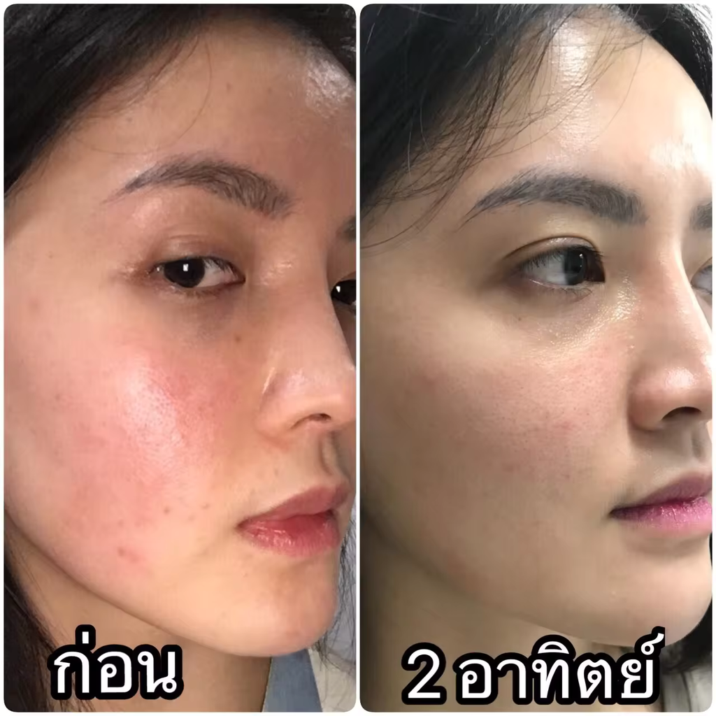 Best Skincare Gentle for Sensitive Skin Viva Skin Booster Premium Skincare From Thailand Good For Your Skin
