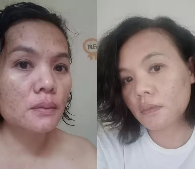 Moringa oil 100 ml. Thai Premium Skincare Best Seller And Premium Quality From Thailand