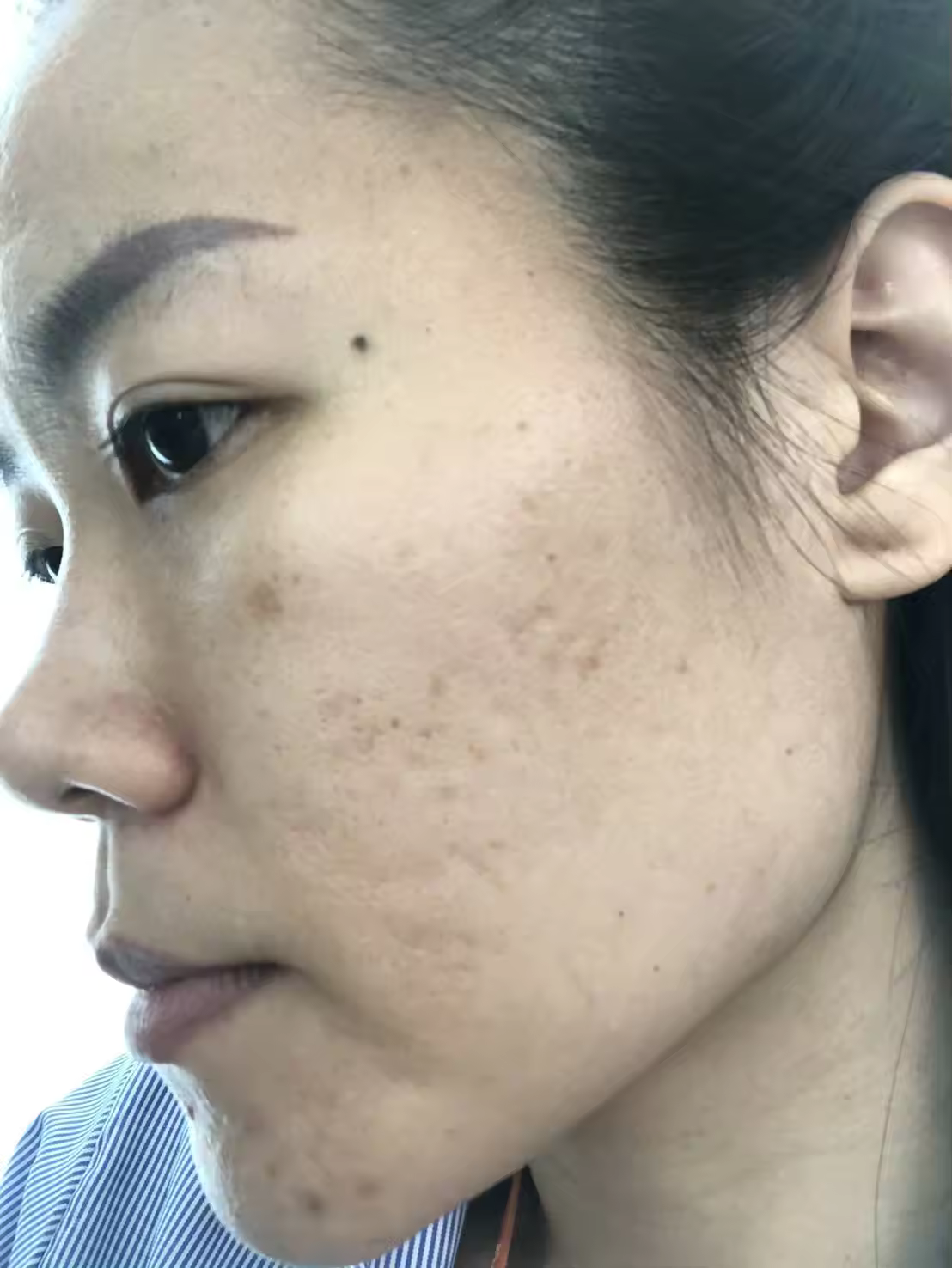 Toner For Brighter Skin Viva Exfoliating Premium Skincare From Thailand Good For Your Skin Best Seller